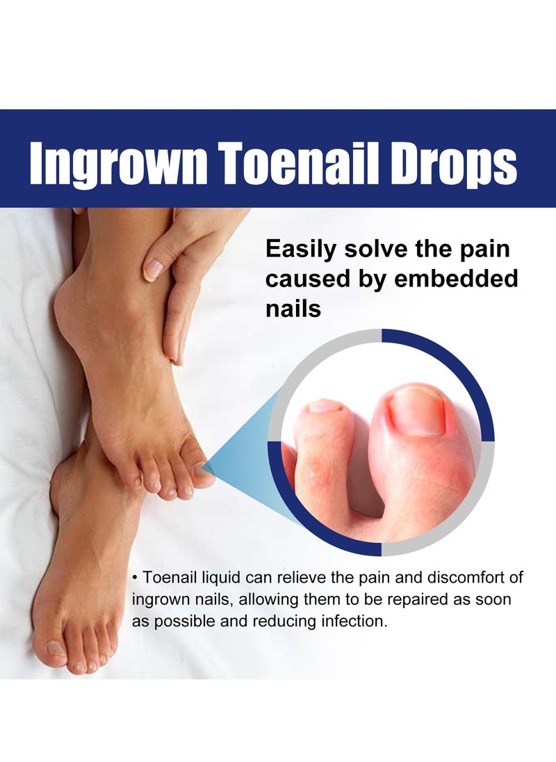 Toenail ingrown relief solution treats ingrown toenails and relieves toenail pain