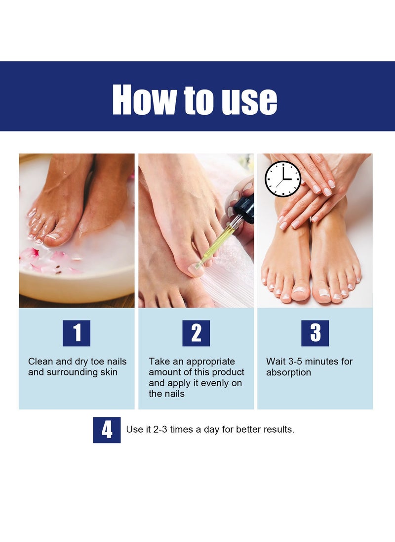 Toenail ingrown relief solution treats ingrown toenails and relieves toenail pain
