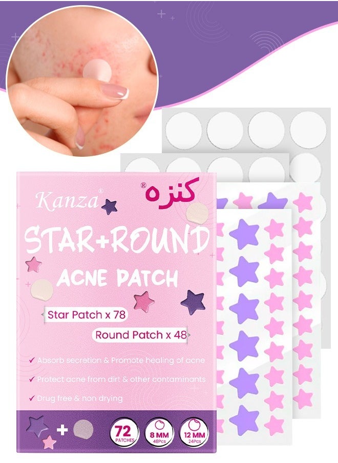 Kanza 126 Pieces Star & Round Acne Patch Set Easy to Use Quick Healing Pain and Scar Free Patches for Face Promotes Wound Healing Natural Formula Acne Patches Star Patch 78 Pieces Round Patch 48 Pieces  - Image 1