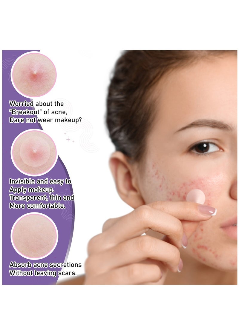 Kanza 126 Pieces Star & Round Acne Patch Set Easy to Use Quick Healing Pain and Scar Free Patches for Face Promotes Wound Healing Natural Formula Acne Patches Star Patch 78 Pieces Round Patch 48 Pieces  - Image 4