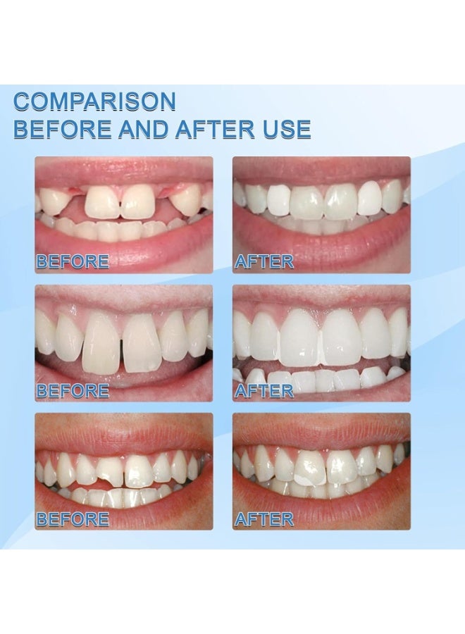 Jaysuing أسنان زائفة قابلة للتشكيل جزيئات بيضاء قابلة لإعادة الاستخدام غير سامة تعبئة مؤقتة لاستعادة الابتسامة كوسبلاي 30 مل - Image 3