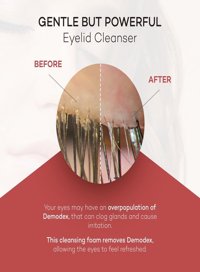 Zocular ZocuFoam Foaming Eyelid Cleanser – Gentle pH-Balanced Cleansing Foam – 25 mL - Image 4