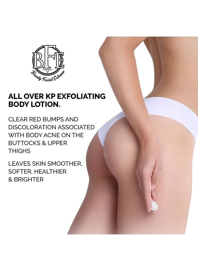 Beauty Facial Extreme - Keratosis Pilaris Exfoliating Body Lotion 12% Lactic Acid. Provides Immediate Moisture & Gentle Exfoliation To Treat Symptoms Associated With Keratosis Pilaris & Dry Bumpy Skin Conditions. - Image 1