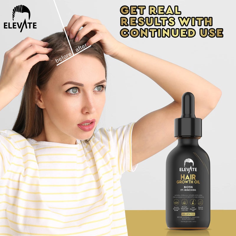 Elevate Hair Regrowth Treatment 5% Minoxidil Solution â€“ Biotin Serum Hair Growth Oil for Men & Women - Thicker Fuller Stronger Hair - Stops Hair Loss & Thinning - Natural Hair Thickening Treatment 2oz - Image 4