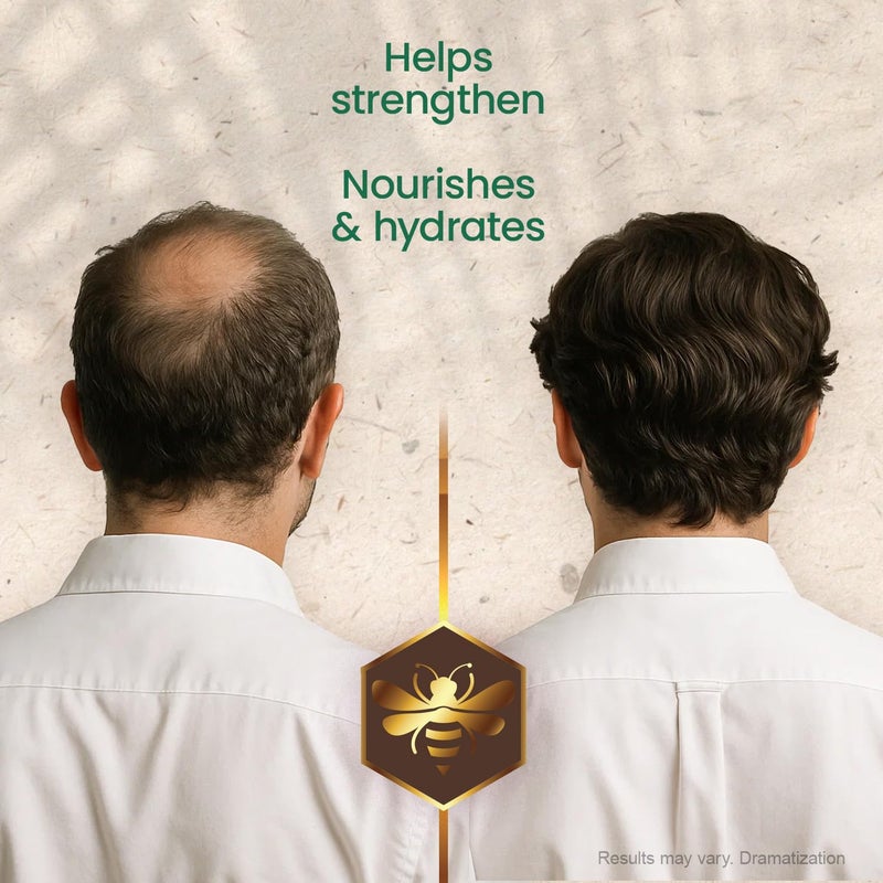 Tio Nacho TÃ­o Nacho Mexican Herbs Anti-Hair Loss Shampoo with Royal Jelly and Rosemary Extract, Strengthening Herbal Shampoo for Men and Women, Nourishing Formula, Healthier Hair, 14 fl oz (Pack of 3) - Image 4