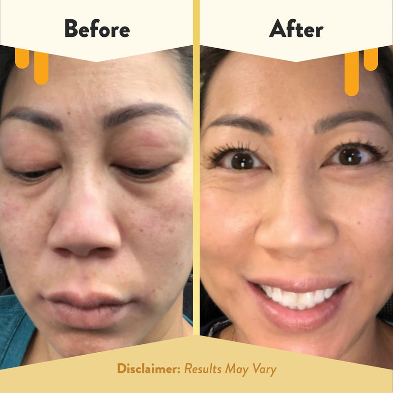 ECZEMA HONEY Soothing Facial Cream - Eczema Lotion for Face, Eyelids, Lips, and More - Natural Dry Skin Repair (2 Oz) - Image 4