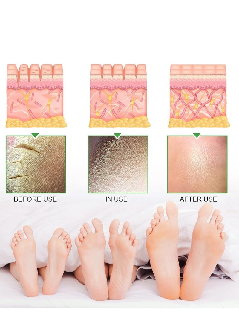 Beafadel Urea 40% Foot Cream, Intensive Cracked Heel Repair & Moisturiser for Dry Skin, Nourishing Treatment for Hands & Feet, Deep Hydration and Repair 30ml - Image 4