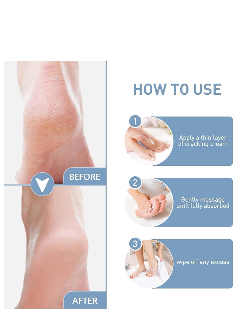 Beafadel Urea 40% Foot Cream, Intensive Cracked Heel Repair & Moisturiser for Dry Skin, Nourishing Treatment for Hands & Feet, Deep Hydration and Repair 30ml - Image 5