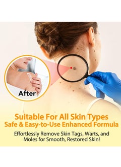Sefudun Bee Venom Moles and Wart Removal Cream Mole and Wart Cream Easy Application and No Irritation Wart and Tag Remover Bee Venom Repair Cream Wart Treatment Cream  - Image 4