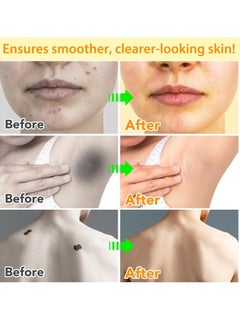 Sefudun Bee Venom Moles and Wart Removal Cream Mole and Wart Cream Easy Application and No Irritation Wart and Tag Remover Bee Venom Repair Cream Wart Treatment Cream  - Image 2