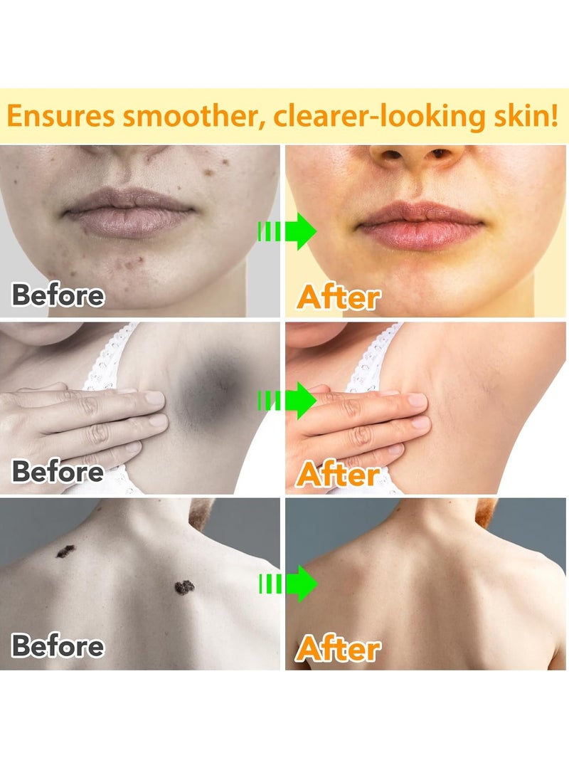 Sefudun Bee Venom Moles and Wart Removal Cream Mole and Wart Cream Easy Application and No Irritation Wart and Tag Remover Bee Venom Repair Cream Wart Treatment Cream  - Image 2