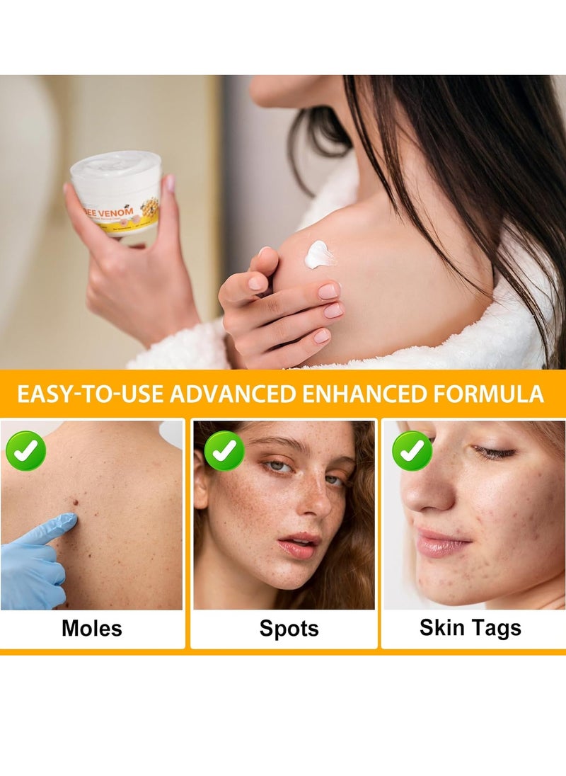 Sefudun Bee Venom Moles and Wart Removal Cream Mole and Wart Cream Easy Application and No Irritation Wart and Tag Remover Bee Venom Repair Cream Wart Treatment Cream  - Image 5