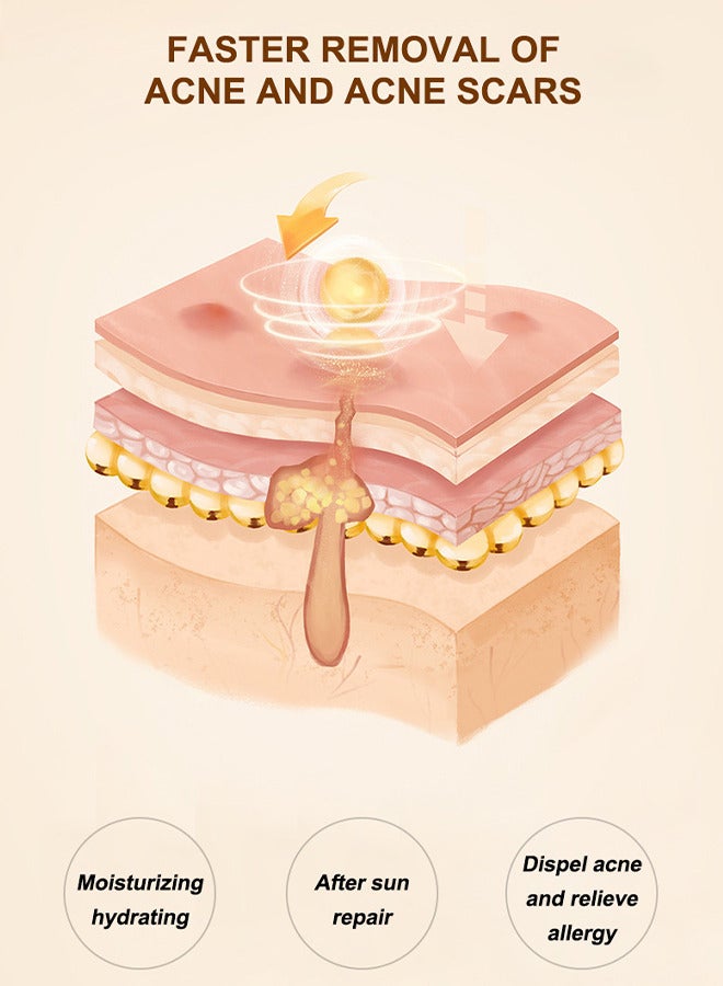 لينماي كريم شجرة الشاي الطبيعي المضاد لحب الشباب ، مهدئ وإصلاح عميق ، إصلاح توازن ندبات حب الشباب ، علاج حب الشباب الكيسي الطبيعي ، علاج حب الشباب الكيسي الطبيعي مناسب للبشرة الدهنية والمعرضة لحب الشباب 30 ج - Image 5