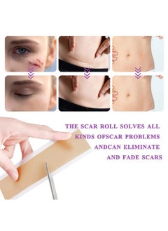 FGHJ Silicone Scar Tape Roll, 1.6” X 60” Medical Tape For Wound Care Bandages Scars Strips For Surgical Scars Keloid, C-Section, Burns, Injuries Acne, Stretch Marks Removal Sheet Tapes (1.6” X 60”)  - Image 3