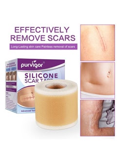 FGHJ Silicone Scar Tape Roll, 1.6” X 60” Medical Tape For Wound Care Bandages Scars Strips For Surgical Scars Keloid, C-Section, Burns, Injuries Acne, Stretch Marks Removal Sheet Tapes (1.6” X 60”)  - Image 2