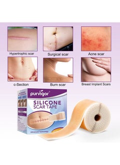 FGHJ Silicone Scar Tape Roll, 1.6” X 60” Medical Tape For Wound Care Bandages Scars Strips For Surgical Scars Keloid, C-Section, Burns, Injuries Acne, Stretch Marks Removal Sheet Tapes (1.6” X 60”)  - Image 4