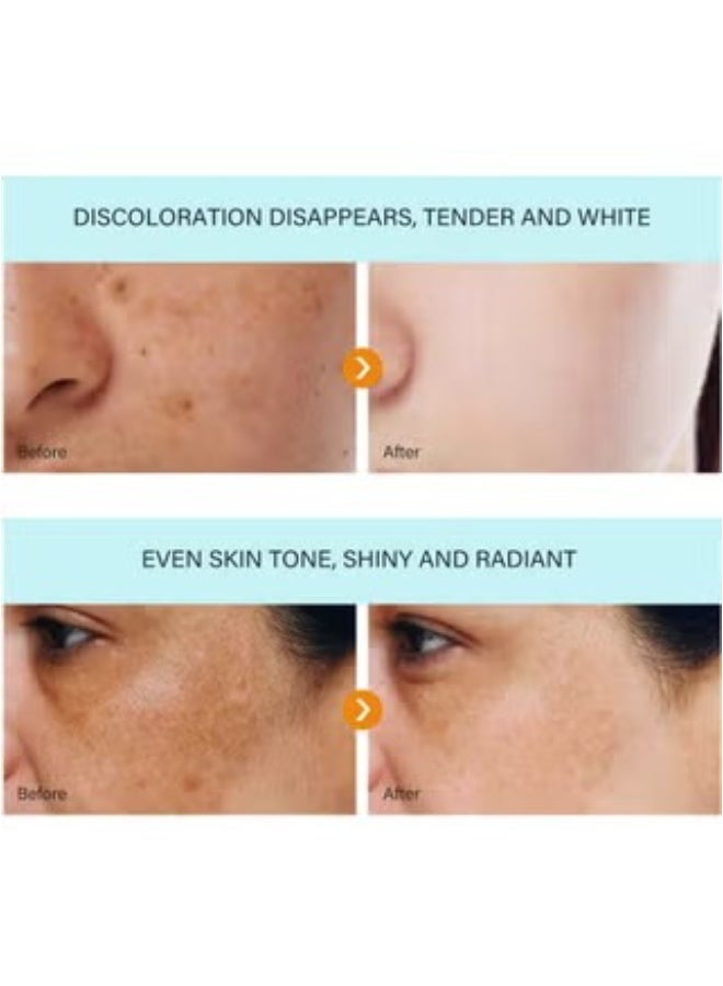 MOOYAM Dark Spot Remover for Face Brightening Treatment Reduces Hyperpigmentation Sun Spots Age Spots and Freckles Evens Skin Tone for All Skin Types  - Image 3
