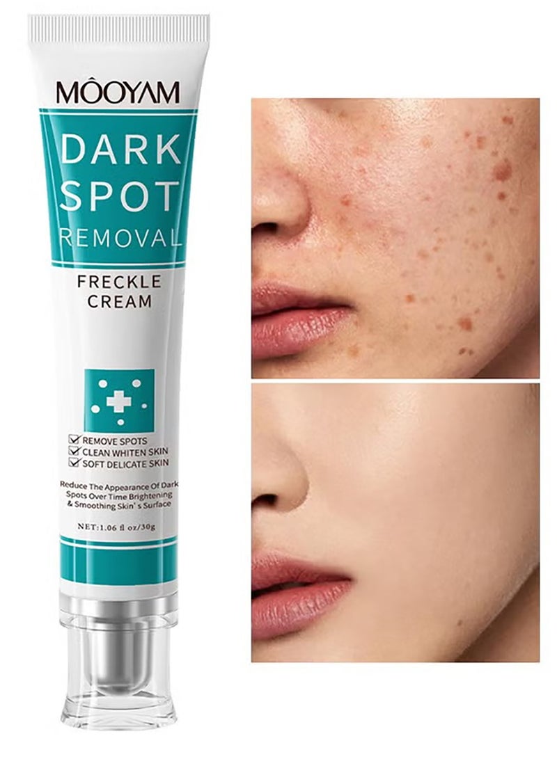 MOOYAM Dark Spot Remover for Face Brightening Treatment Reduces Hyperpigmentation Sun Spots Age Spots and Freckles Evens Skin Tone for All Skin Types  - Image 5