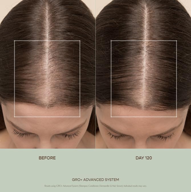 VEGAMOUR GRO+ Advanced Balancing Shampoo | Lightly Exfoliates, Cleanses and Removes Buildup Without Stripping | For Severe Signs of Thinning | Color Safe, Vegan, Cruelty-Free (8 Fl Oz) - Image 3