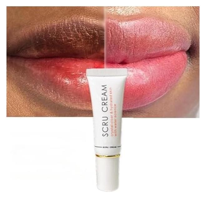 ميكسيو كريم سكرو - كريم تقشير الشفاه السحري لتفتيح الشفاه، يزيل التصبغات ويزيل الهالات السوداء، مرطب شفاه وردي باهت، مفتح، مرطب مضاد للتشقق، شفاه ناعمة، مقشر لطيف للشفاه المتشققة والجافة. - Image 1
