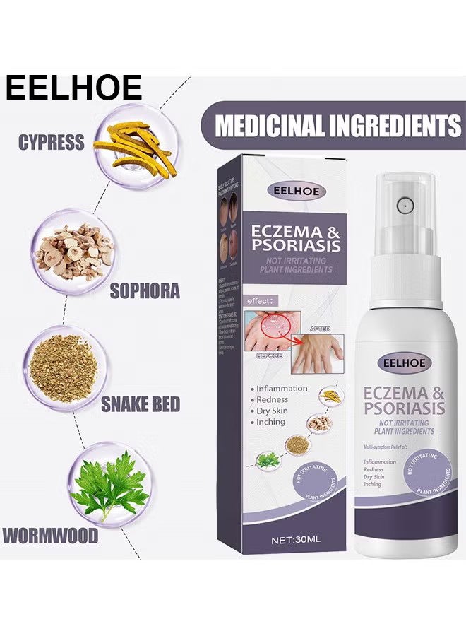 إيلهو الاكزيما والصدفية رذاذ متناهية الصغر 30ml ، إصلاح الجلد من ناحية القدم موس ، تخفيف الحكة ، العناية بالبشرة وتنظيف رذاذ ، مضاد للجراثيم آمنة دون تهيج - Image 3