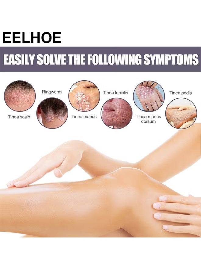 إيلهو الاكزيما والصدفية رذاذ متناهية الصغر 30ml ، إصلاح الجلد من ناحية القدم موس ، تخفيف الحكة ، العناية بالبشرة وتنظيف رذاذ ، مضاد للجراثيم آمنة دون تهيج - Image 4