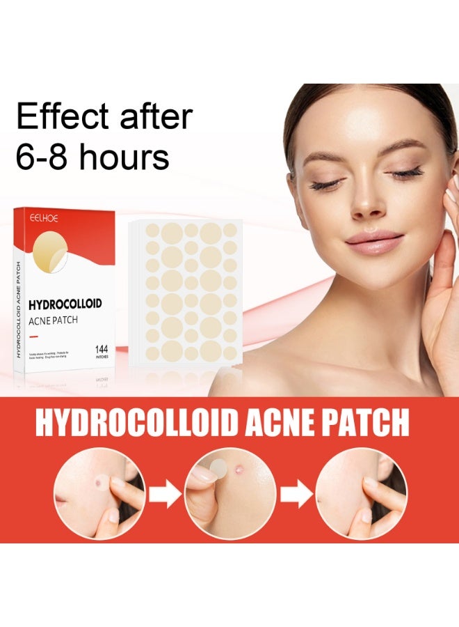 144 Count Pimple Patch |  Acne Stickers for Day & Night, Unisex Skin Care - Image 2