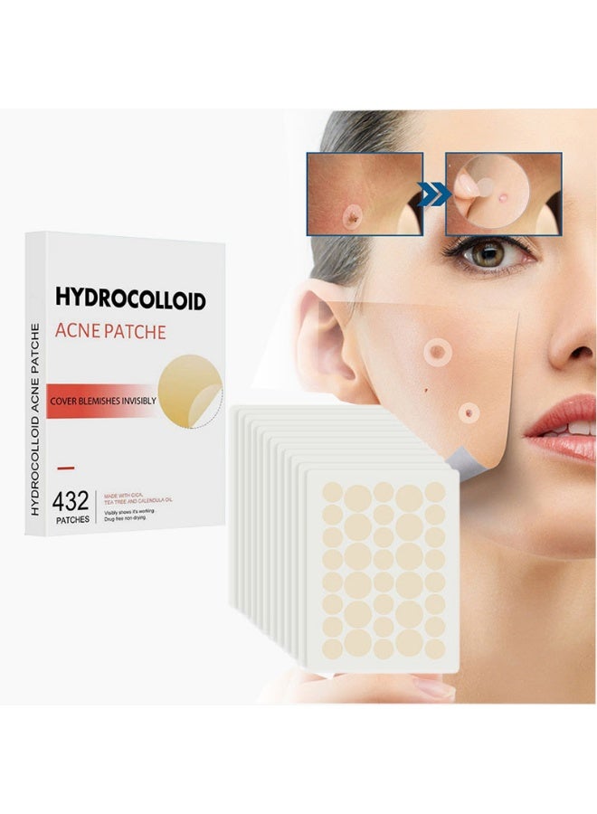 144 Count Pimple Patch |  Acne Stickers for Day & Night, Unisex Skin Care - Image 1