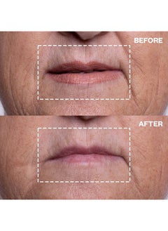 WRINKLES SCHMINKLES Mouth & Lip Wrinkle Patch, 1-Pack, Reusable Hypoallergenic Silicone Smoothing Pads for Lip Wrinkle Prevention  - Image 3