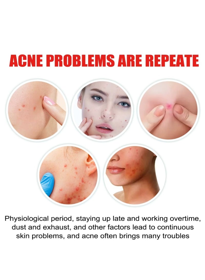 Jaysuing 200 Pcs Pimple Patches Hydrocolloid Non Drying Acne Patches for Face Colorful Moon Pimple Spot Sticker with Hyaluronic Acid Tea Tree Oil and Centella Oil Pimple Patches for Covering Blemishes and Zits - Image 2
