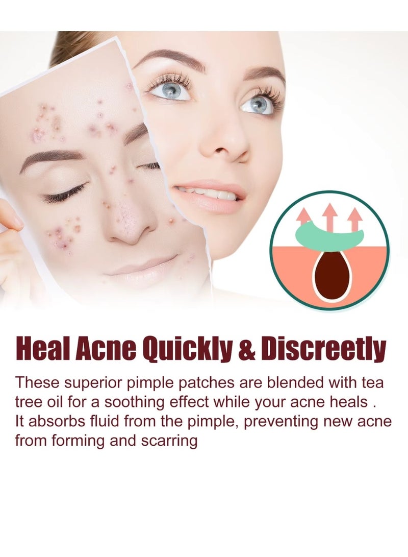 Jaysuing 200 Pcs Pimple Patches Hydrocolloid Non Drying Acne Patches for Face Colorful Moon Pimple Spot Sticker with Hyaluronic Acid Tea Tree Oil and Centella Oil Pimple Patches for Covering Blemishes and Zits - Image 3