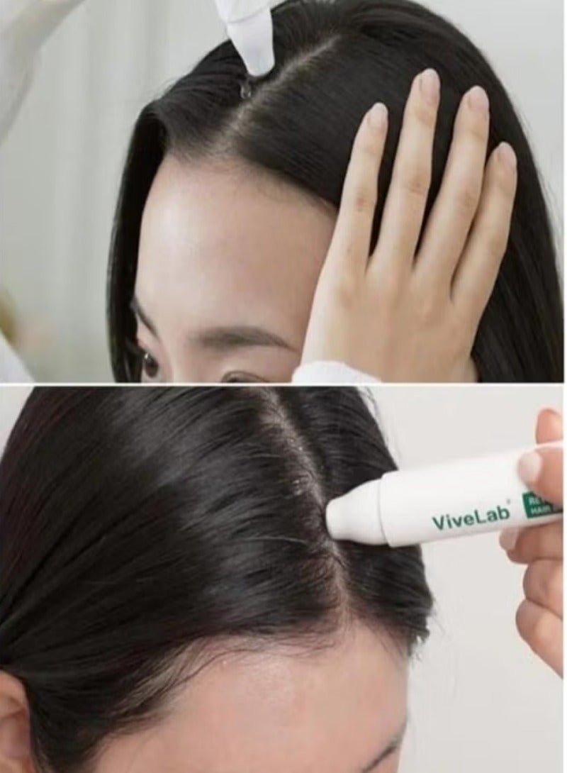 ViveLab ﻿ Scalp&Hair Serum for Thinning Hair 15ml–Clinically Tested,Nourishing Formula with Biotin,peptide. Promotes Healthy Scalp&Fuller-Looking Hair， Hair Regrowth Roller Stick Type, Natural Treatment Oil Scalp Care for Thicker and Fuller Hair Enhancer - Image 3