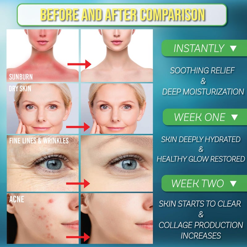 Green Leaf Naturals Aloe Vera Spray | 99% Cold-Pressed Aloe Vera Juice with Vitamin C, E & A | Hair, Skin, Facial Moisturizer, Sunburn Relief & After Sun Lotion 12oz - Image 3