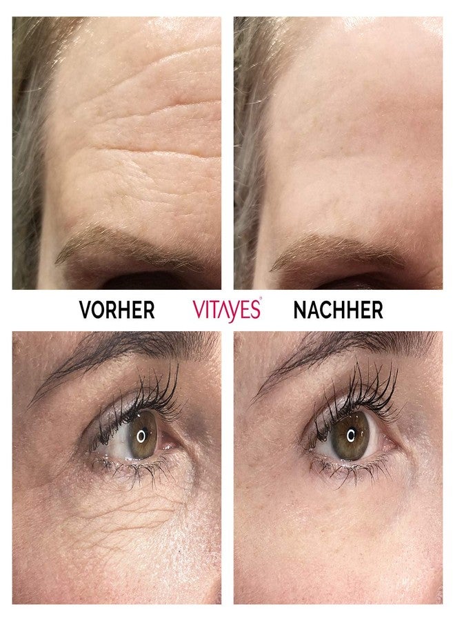 VITAYES Instant Ageback Lifting Cream, Dark Circle Bags Under Eye Remover, Anti Wrinkle and Fine Lines Face Lift Cream 0.24 Oz - Image 2