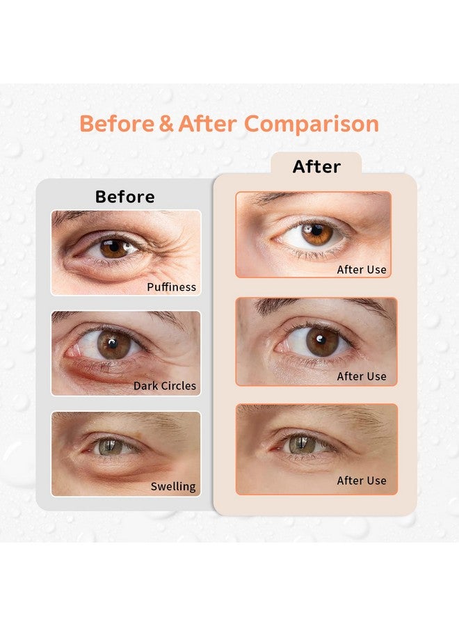 كونبيلا جل ثلجي، وسادات تبريد للعين قابلة لإعادة الاستخدام، ولصقات تحت العين، علاج ساخن وبارد لاحمرار العين، وتسكين الألم والاسترخاء (برتقال) - Image 4