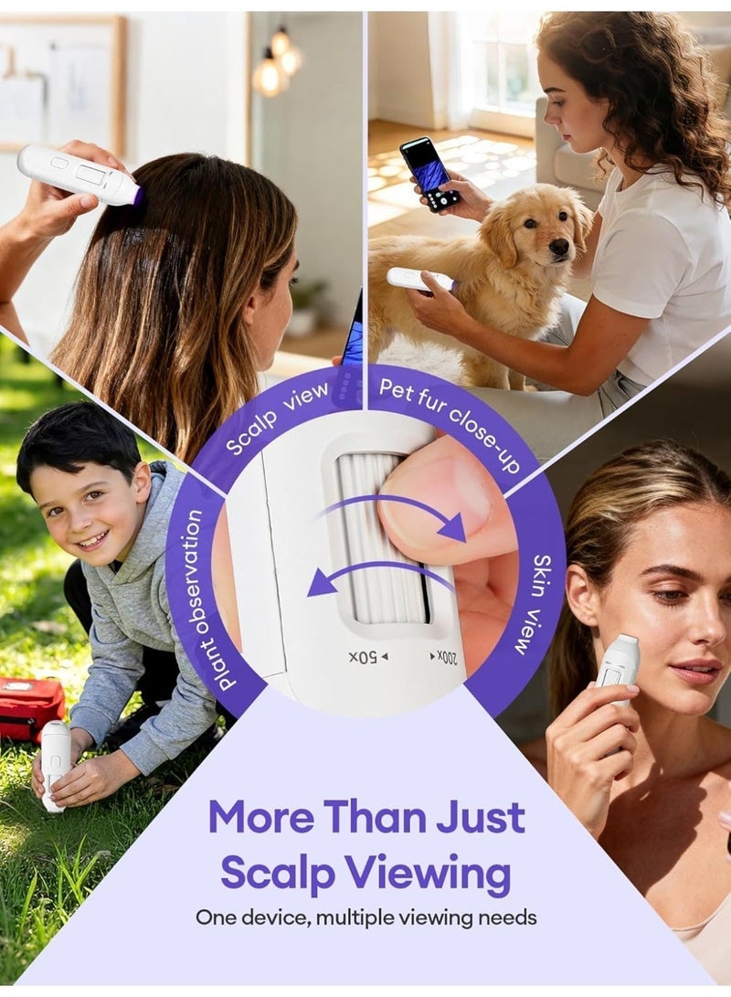 L LULONG Wireless Scalp Camera Handheld Microscope with 50x-200x Zoom and LED Light, WiFi Portable Magnifier (Compatible with Phones/iPads), Professional Skin/Hair/Follicle Analyzer - Image 4