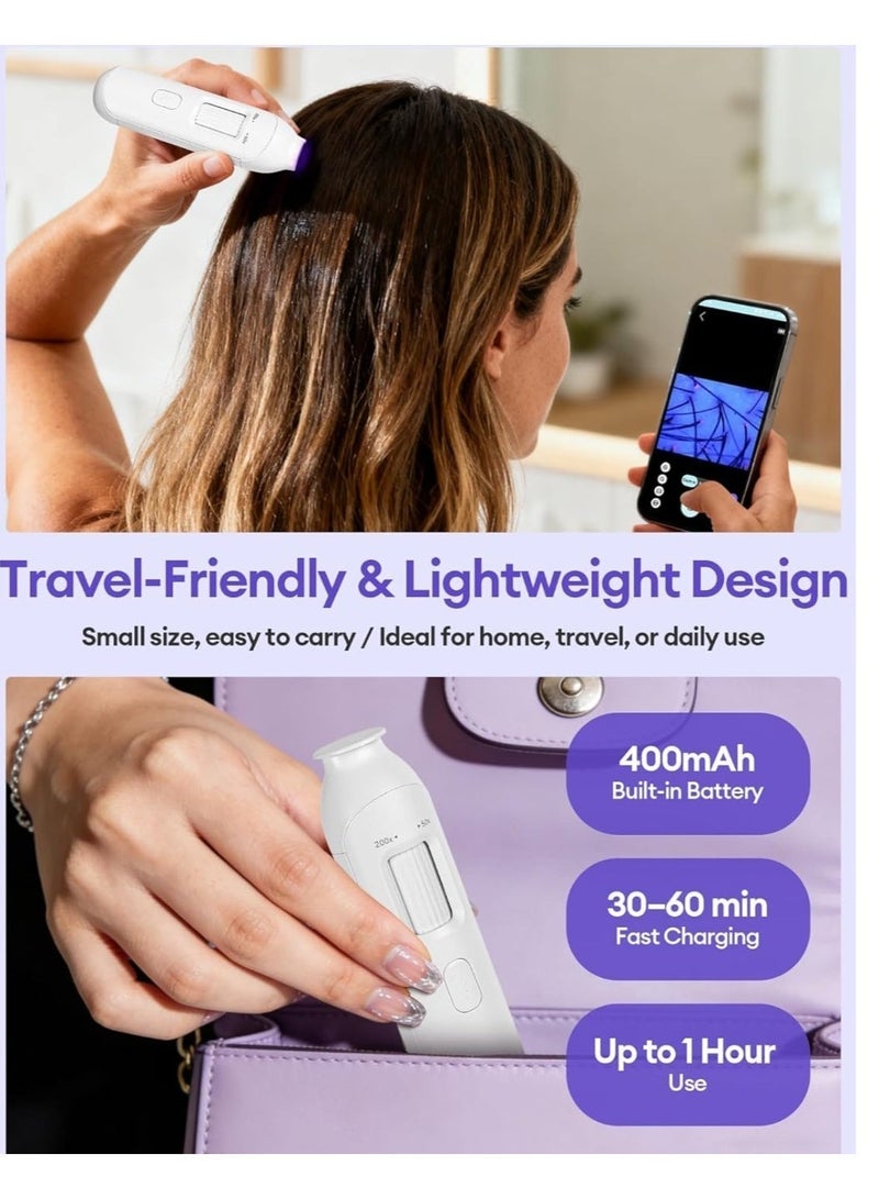 L LULONG Wireless Scalp Camera Handheld Microscope with 50x-200x Zoom and LED Light, WiFi Portable Magnifier (Compatible with Phones/iPads), Professional Skin/Hair/Follicle Analyzer - Image 2