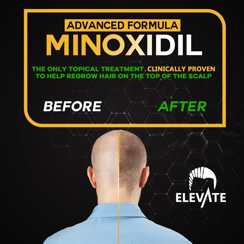 ELEVATE 5% Minoxidil Hair Growth Spray - Alcohol Free Non Oily Formula Extra Strength Professional Treatment for Hair Loss/Regrowth - Stimulate Hair Follicles for Men & Women - 1 Month Supply - Image 3
