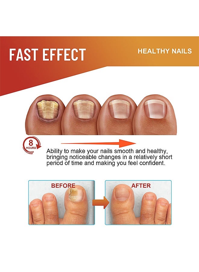 ximonth 32 Patches Nail Patches, Fungal Nail Patch Nail, Nail Discoloration & Cracked Nails Restore Healthy Nail Appearance - Image 4