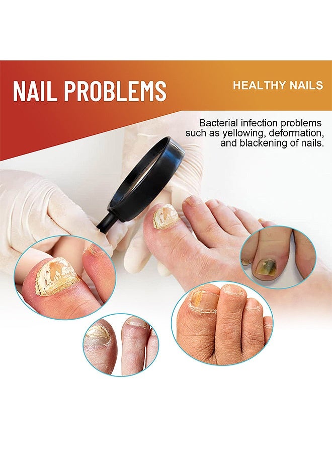 ximonth 32 Patches Nail Patches, Fungal Nail Patch Nail, Nail Discoloration & Cracked Nails Restore Healthy Nail Appearance - Image 3
