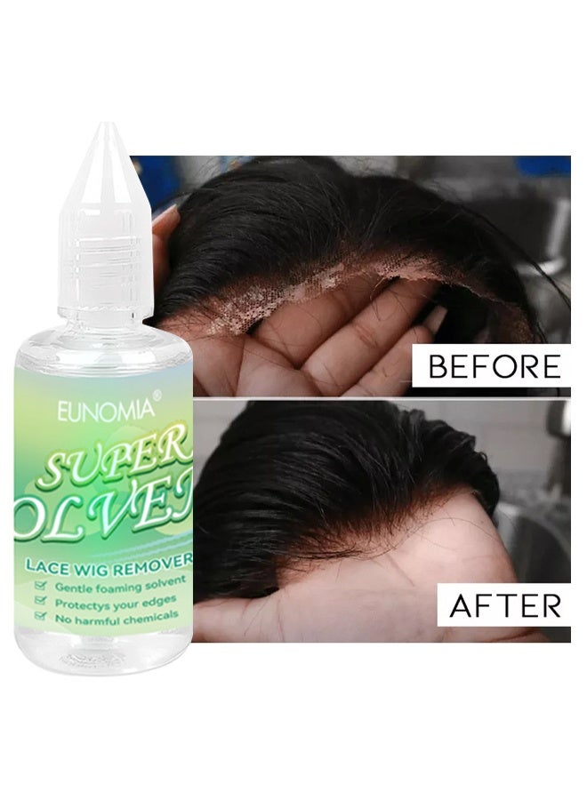 يونوميا مزيل شعر مستعار الدانتيل - مزيل غراء الشعر المستعار ، مزيل شريط الدانتيل النشط ، منظف فروة الرأس مزيل الغراء (30 مل) - Image 1