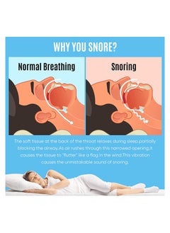 NNEWVANTE Stop Snoring Mask, Stop Snoring Device, Help Stop Snoring, Reduce Snoring Solution, Comfortable, Adjustable, Suitable for Men/Women. Allow people to get a good and restful night's sleep.  - Image 3