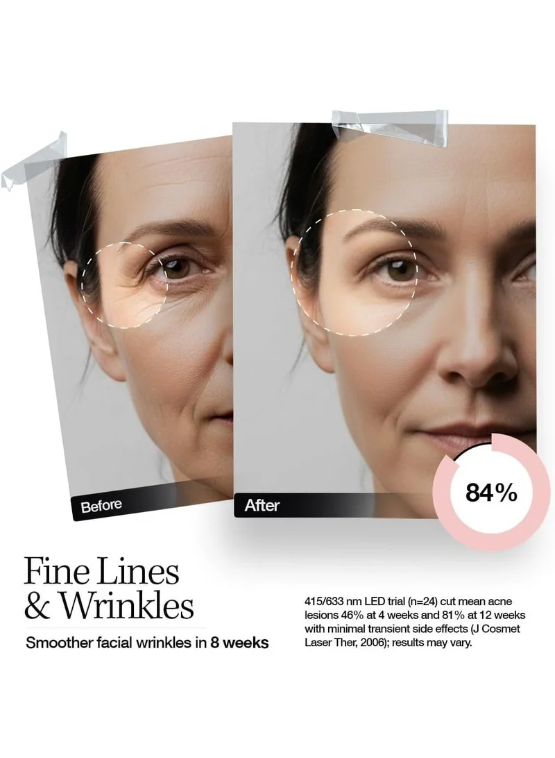 ELLE  Radiance Boost Pro LED Face Mask – FDA Approved & Clinically Proven Light Therapy for Glowing, Youthful Skin | Red, Blue & Infrared Light | Boosts Collagen, Reduces Wrinkles, Breakouts & Blemishes | Comfortable Silicone Fit  | Best Price UAE