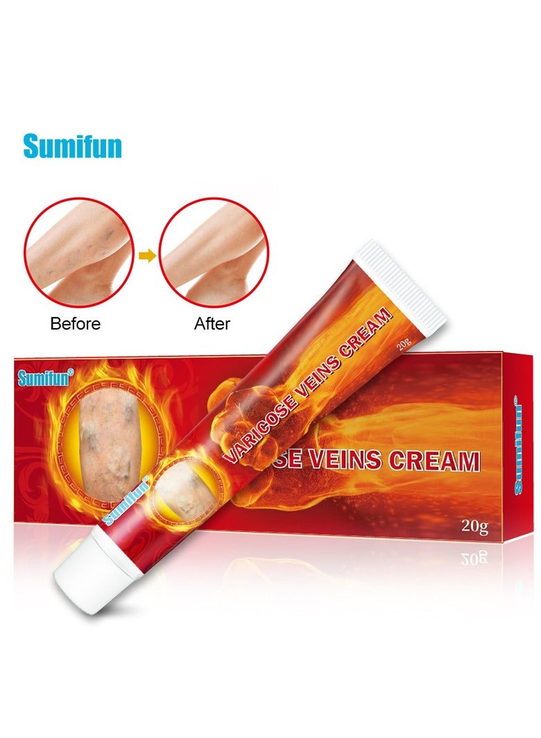 Sumifun Varicose Veins Cream,Minimize Varicose Veins Relieve Swelling And Pain Improve Blood Circulation 20g  - Image 1
