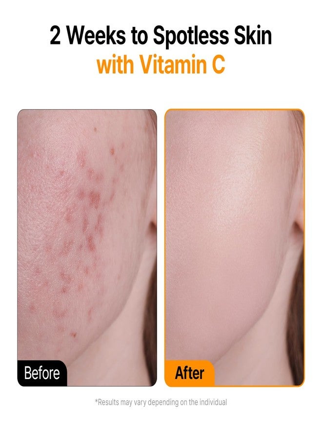 VEGANIFECT Vita C Ampoule, Dark Spot Correction, Boosting Skin Luminosity, Korean Skin Care, Vegan,0.5 Fl Oz - Image 3