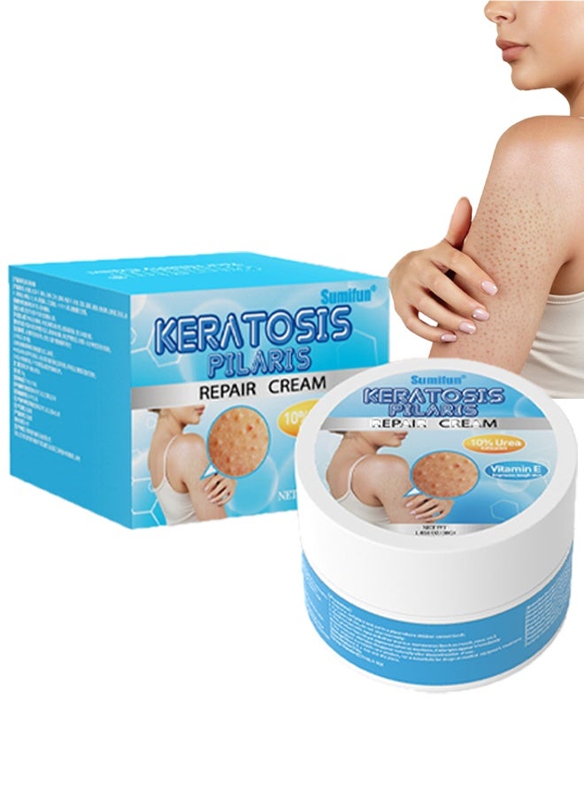 Sumifun Keratosis Pilaris Repair Cream 30g, Vitamin E Cream, Chicken Skin Cream Urea Exfoliates Lumps - Image 1