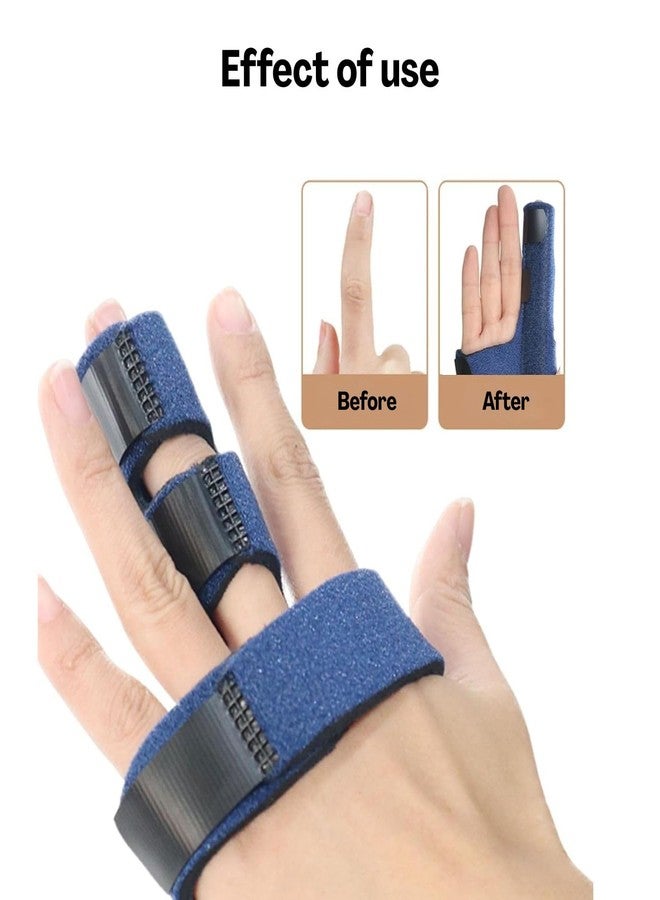Homeaura 2pcs Finger Splint for Index, Middle & Ring Finger | Adjustable Support | Comfortable Fit | Injury Recovery | Pain Relief | Sprain & Fracture Protection - Image 4