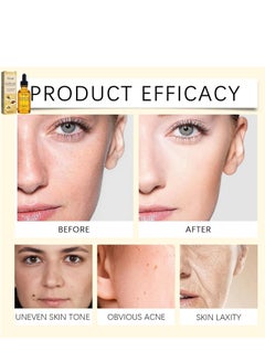 Hoygi Rosehip Black Seed Oil, Natural Organic Fortifying Oil, Face Serum for Women, Moisturizing Glow Oil, Hydrating Serum, Anti Wrinkle Face Cream, Skincare Serum, Facial Oils for Women 30ml  - Image 2
