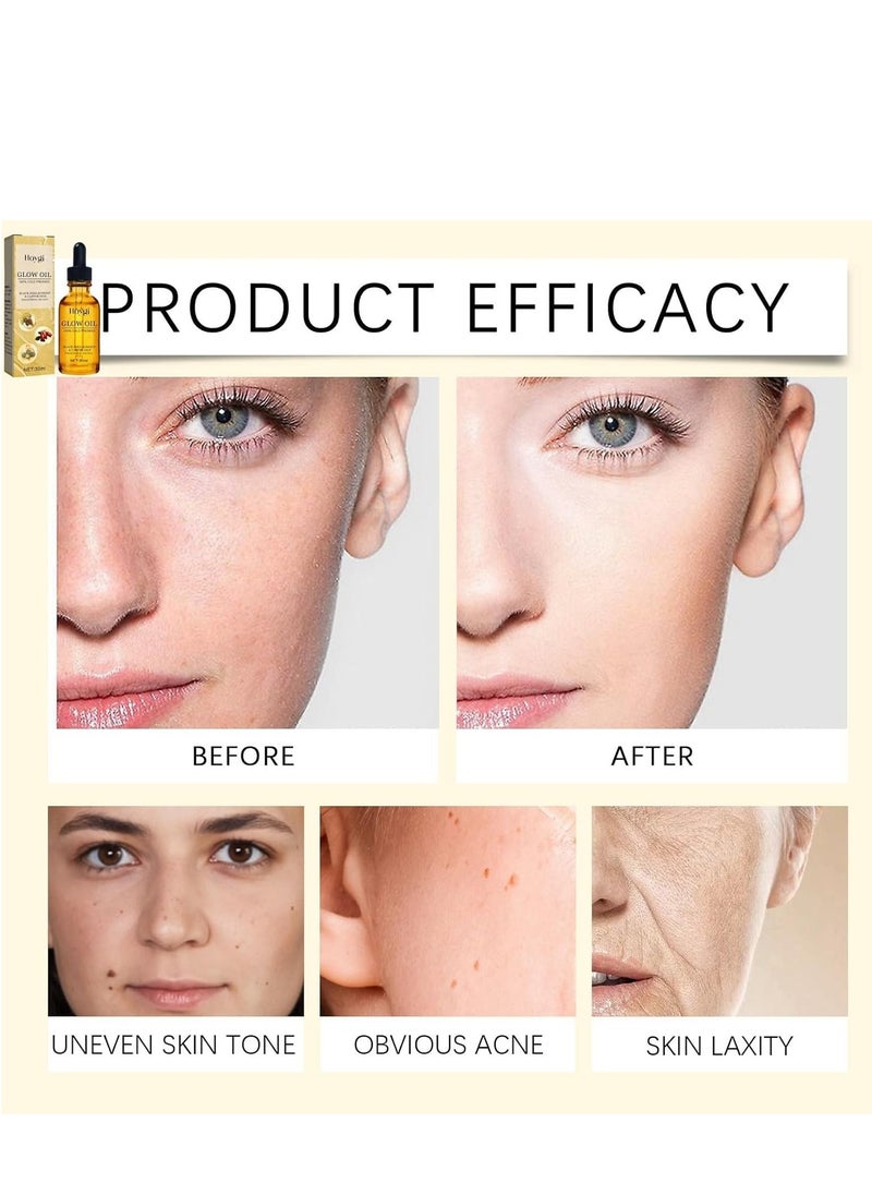 Hoygi Rosehip Black Seed Oil, Natural Organic Fortifying Oil, Face Serum for Women, Moisturizing Glow Oil, Hydrating Serum, Anti Wrinkle Face Cream, Skincare Serum, Facial Oils for Women 30ml  - Image 2