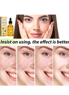 Hoygi Rosehip Black Seed Oil, Natural Organic Fortifying Oil, Face Serum for Women, Moisturizing Glow Oil, Hydrating Serum, Anti Wrinkle Face Cream, Skincare Serum, Facial Oils for Women 30ml  - Image 5